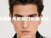 玉林市光敏复合树脂补牙医院排名top10强新出炉（玉林市光敏复合树脂补牙口腔医院靠谱技术好）