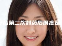 牙齿第二次封药后很疼是为什么牙齿第二次封药后更疼