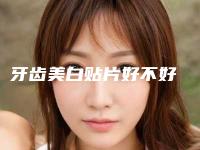 牙齿美白贴片好不好