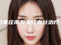 石家庄市鼻尖红血丝治疗整形医院(石家庄德润医疗美容门诊部上榜)