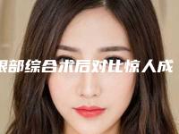 眼部综合术后对比惊人成都军大整形果反馈