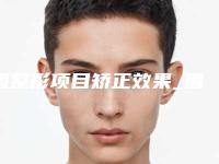 眉整形项目矫正效果_眉矫正手术能够矫正眉间距过宽