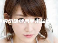 疤痕切除缝合手术缺点!疤痕切除缝合手术要花费多少钱