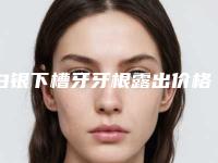 白银下槽牙牙根露出价格会不会很贵