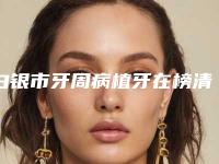 白银市牙周病植牙在榜清单top10强力推-白银市牙周病植牙口腔医生