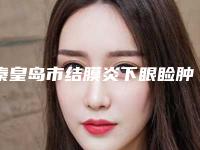 秦皇岛市结膜炎下眼睑肿收费明细已上线，请查收(2025年均价为：6382元）