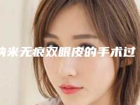 纳米无痕双眼皮的手术过程一起来了解一下（纳米无痕双眼皮术后照片）