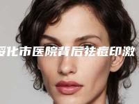 绥化市医院背后祛痘印激光手术多少钱(绥化那样美医疗美容门诊部医生实力测评_网友反馈)