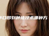半口即刻种植技术哪种方法安全