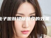 光子嫩肤祛除颈纹的效果好吗