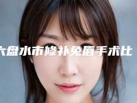六盘水市修补兔唇手术比较好医院(贵州省六盘水市人民医院终于入围了)