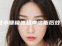 做小腿极速超声溶脂后效果如何