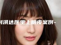 刘洪达医生上眼皮案例-价格(价目)表详细火热出炉