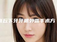 商丘下牙牙根外露手术方法最安全