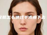 咬肌怎么通过手术瘦下去咬肌能瘦下去吗