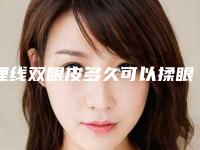 埋线双眼皮多久可以揉眼,埋线双眼皮多久能揉眼睛吗