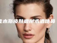 佳木斯皮肤磨削术酒糟鼻治疗手术会不会留下后遗症
