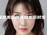 保定发际线高植发后对生活会有什么影响