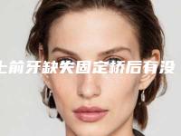 上前牙缺失固定桥后有没有后遗症呢