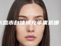东营市自体填充苹果肌哪个医院好(东营市人民医院烧伤整形科可以放心选)