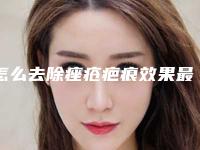 怎么去除痤疮疤痕效果最佳 - 痘坑修复 - 疤痕论坛，祛痘留下的疤痕怎样修复
