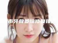 承德市牙骨萎缩修复排名top10强全新一览-承德市牙骨萎缩修复口腔医生