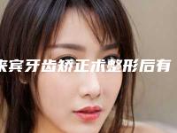 来宾牙齿矫正术整形后有没有后遗症