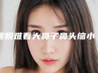 摆脱难看大鼻子鼻头缩小要多少钱（把鼻头缩小要多少钱）