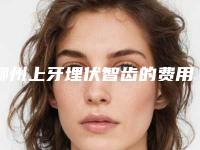 柳州上牙埋伏智齿的费用介绍「柳州上牙埋伏智齿术的费用由哪些因素决定」