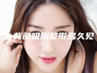 新乡背部吸脂整形多久见效果（背部吸脂多久恢复）