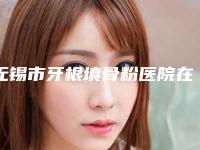 无锡市牙根填骨粉医院在榜清单前10位怎么样（无锡钱仲明口腔诊所正规私立推送）