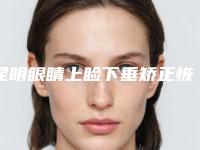 昆明眼睛上睑下垂矫正恢复后有什么护理方法