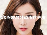 武汉深覆合牙齿治疗手术的坏处是什么