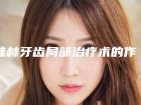 桂林牙齿局部治疗术的作用有效期是多久