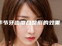 毕节牙齿覆合整形的效果到底好不好