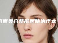 济南美容整形医院治疗太田痣整形的效果有哪些因素影响