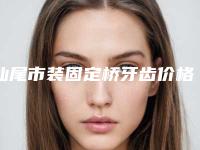 汕尾市装固定桥牙齿价格价位表一览，附科室-汕尾市装固定桥牙齿价格