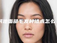 河池面部毛发种植术怎么样,可维持多久