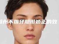 滁州不拨牙隐形矫正的效果能保持多长时间