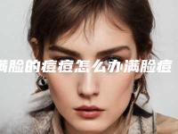 满脸的痘痘怎么办满脸痘痘怎么办