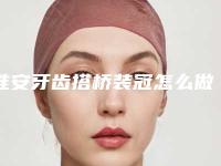 淮安牙齿搭桥装冠怎么做才比较安全