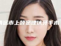 清远市上颌窦埋伏牙手术医生排名榜名单出炉-清远市何艳屏口腔医生
