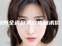 湖州全瓷冠美容修复术价格的影响因素