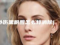 外伤黑眼圈怎么样消除(眼部受伤后的黑眼圈)