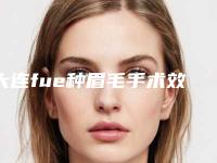 大连fue种眉毛手术效果对比图