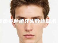 奥齿泰种植牙失败修复术适合人群