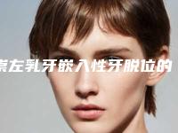 崇左乳牙嵌入性牙脱位的费用一般需要多少钱呢