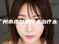 广州市皮肤磨削术治疗太田痣价位表种草经典项目-广州市皮肤磨削术治疗太田痣手术价格有人知道吗