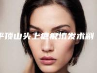 平顶山头上疤痕植发术副作用是什么呢
