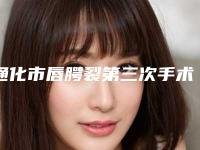 通化市唇腭裂第三次手术医生排名榜结果正式发布（刘志医生风采展现）